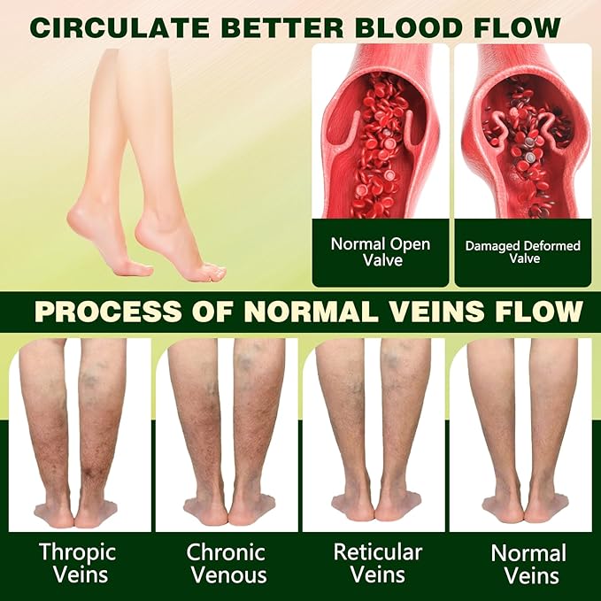 FluidEase Leg Therapy Edema Cream, Edema Relief for Legs and Feet, Natural Comprehensive Care Herbal Massage Cream for All Skin Types