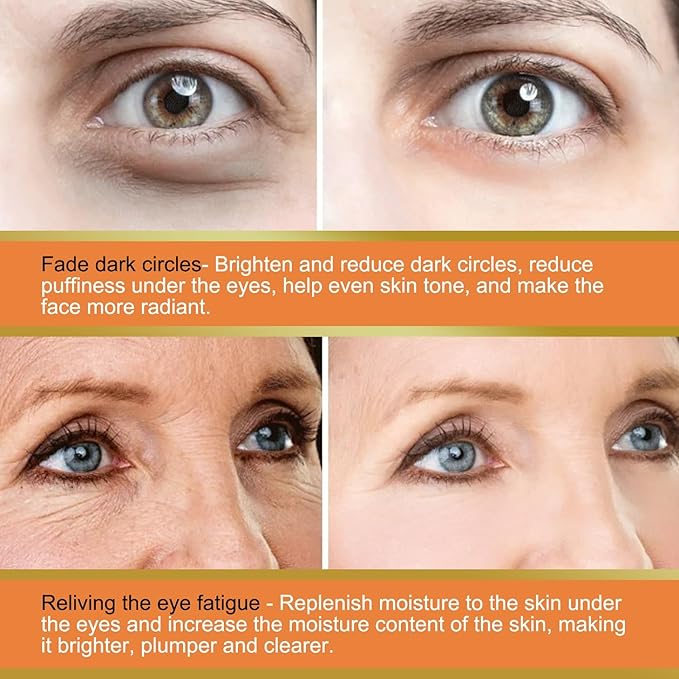 LOYOTICE 3Pcs Revive Glow Vitamin C Eye Balm, Hydrating Eye Cream, Glow Eye Balm Stick, Brightening and Reducing Dark Circle, Reduces Puffiness