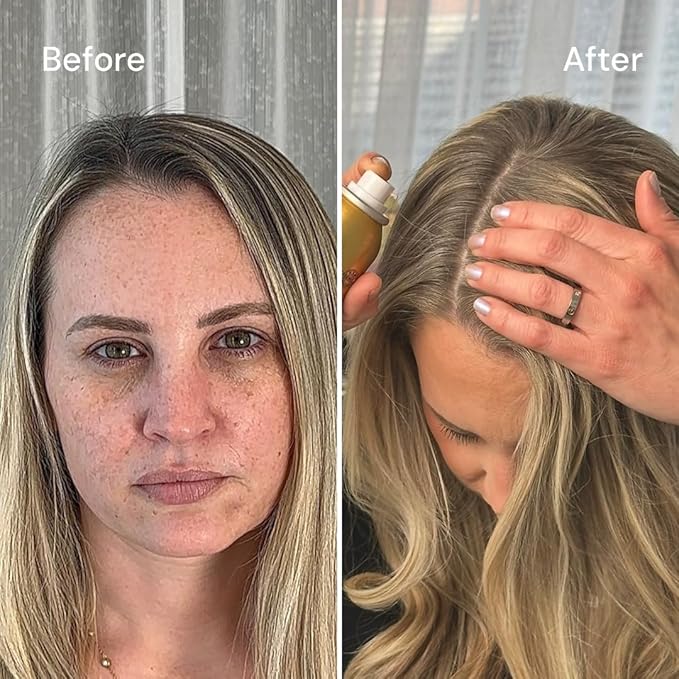 STYLE EDIT MEDIUM BLONDE Root Concealer Touch Up Spray Instantly Covers Greys And Dark Roots - Professional Salon Quality Blonde Perfection Grays Cover Up Hair Products for Women 4 Ounce PACK OF 5