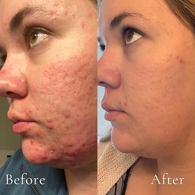 The Daily Essential Jojoba Cleansing Oil For Face Pore Cleaner Non-Toxic + Plant Based | Gentle Deep Cleanser, Makeup Remover, Moisturizing | Cleaner Healthy Skin