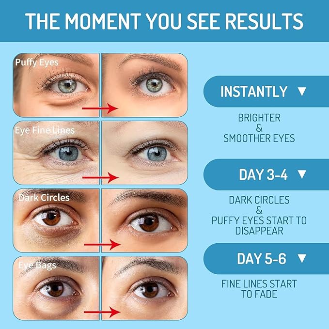 Revitalizing Under Eye Patches, 30 Pairs Brightening & Smoothing Eye Gels with Retinol, Collagen, Hyaluronic Acid, Hydrating Cooling Anti Aging Under Eye Masks for Dark Circles, Puffiness & Fine Lines