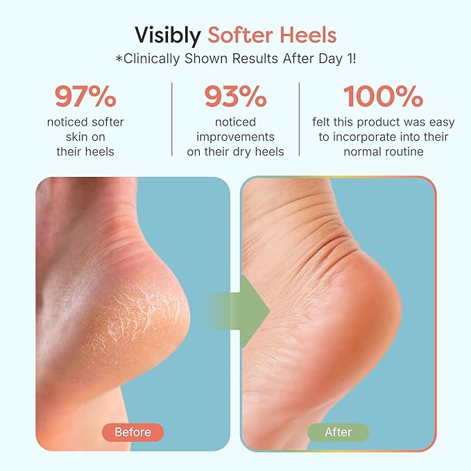 ZenToes Moisturizing Socks for Cracked Heel Treatment, Vitamin E, Olive Oil and Jojoba Oil Heel Socks, Stocking Stuffers for Women, Spa Self Care Gifts for Women (Fuzzy Blue, Regular)