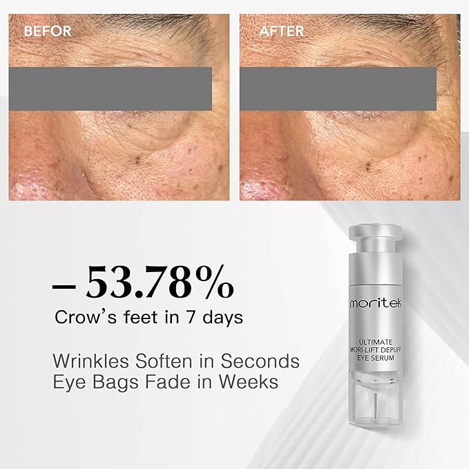 Deep Anti-Aging Wrinkle Remover & Eye Serum instantly reduces the appearance of under-eye bags, puffiness, dark circles, wrinkles, fine lines, and crow's feet