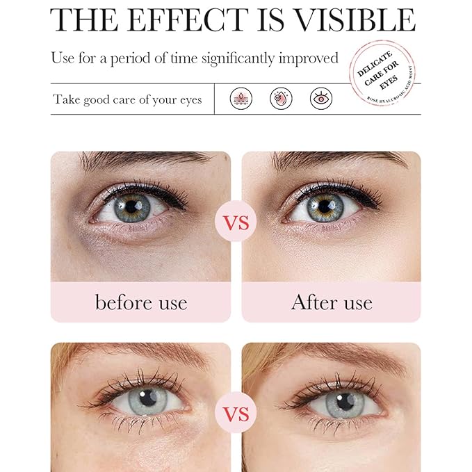 Aloe Vera Eye Masks - 60 PCS Under Eye Patches for Puffy Eyes and Dark Circles Treatments - Hydrating Eye Mask Skincare, Eye Gel Pads for Eye, Reduce Wrinkles and Fine Lines, Improve Eye Skin (Set D)