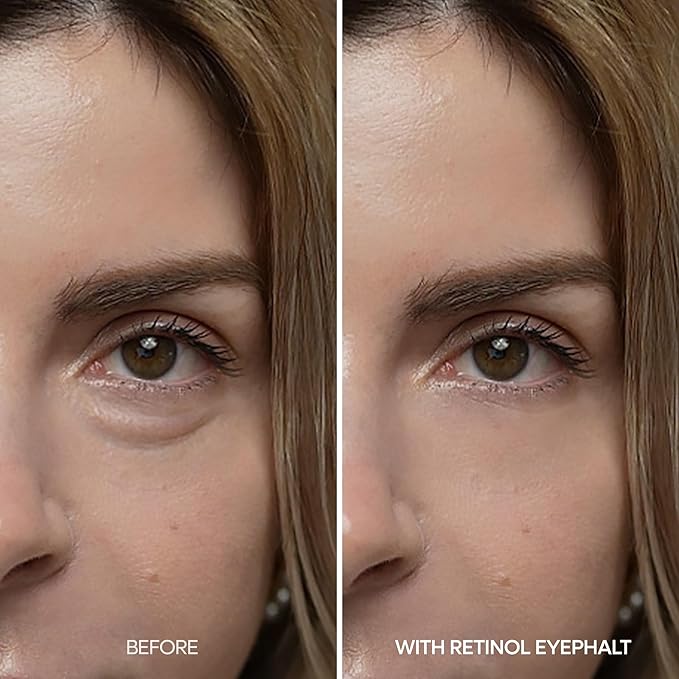 Dr.Melaxin Retinol Eyebag Cream for Puffiness, Dark Circles & Fine Lines, Wrinkle, EGF Anti-Aging Under Eye Moisturizer with Niacinamide&Ceramide Makeup friendly korean skin care