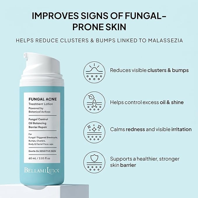 BellamiLuxx Fungal Acne Treatment Lotion: Helps with Bumps, Clusters, Itch & Redness – Lightweight Anti-Fungal Face & Body Moisturizer for Fungal Skin with Natural Actives & Soothing Plant Extracts