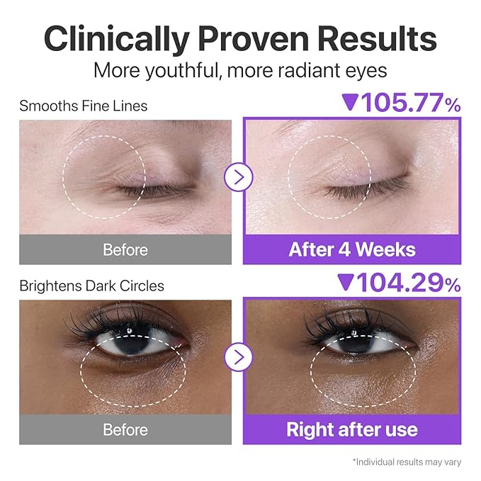 numbuzin No.9 Eye Cream | NAD+ Retinol Volumetox Eye Cream | Dark Circles, Glow Up, Firming, Wrinkles, Fine Lines, Depuff | Peptides, Niacinamide | Restores Radiance for Undereyes | 0.33 fl. oz.