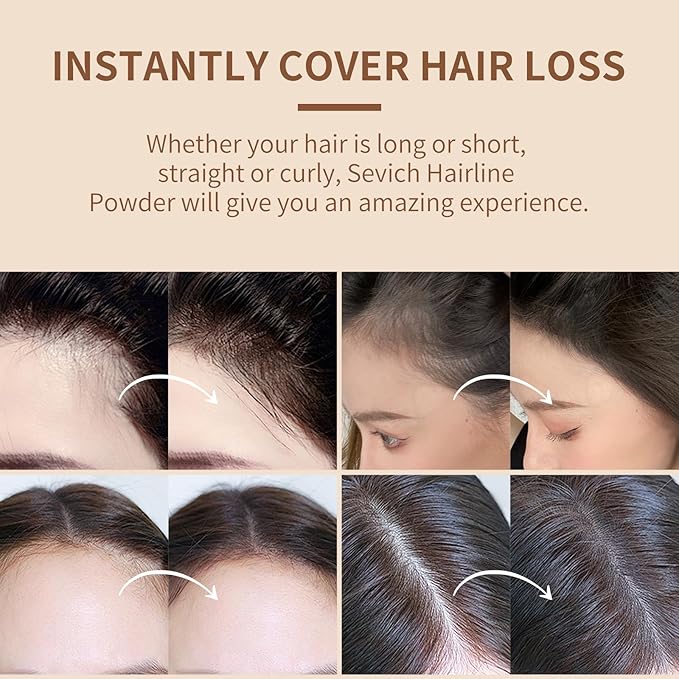Sevich Hairline Powder,Instantly Conceals Hair Loss, Root Touch up Powder, Hair Shadow Toppers for Women & Men, Touch Up for Thinning Gray Hair, Windproof & Sweatproof,Black