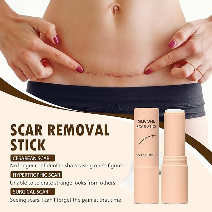 Scar Solutions Silicone Scar Stick, 60% Silicone for Face and Body Skin, Lightweight & Easy to Apply, Natural Ingredients Gentle on All Skin Types, Stick Applicator Manual Massage Suitable-2PCS