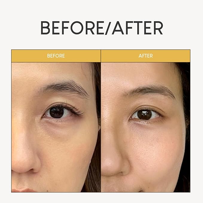Jung Beauty Microdart Eye Patches (4 Pairs) - Bakuchiol, Niacinamide & Peptide Infused - Visibly Plumps, Hydrates & Smooths Under Eye Texture