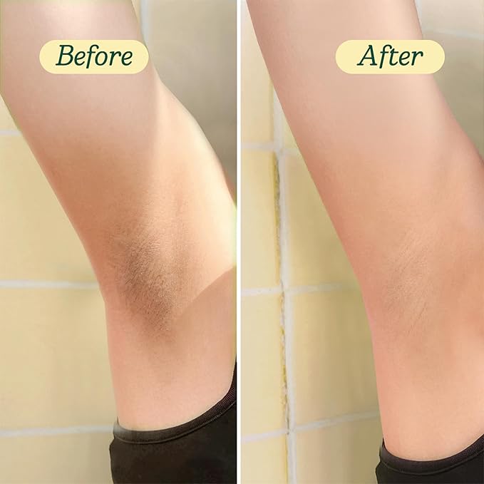 Glowy Body Peel - 25% AHA Exfoliating Body Scrub for Women - Improves Uneven Texture on Underarms, Elbows, Knees & Buttocks - Gentle Body Skin Care Products - 1.76 Oz | 50g