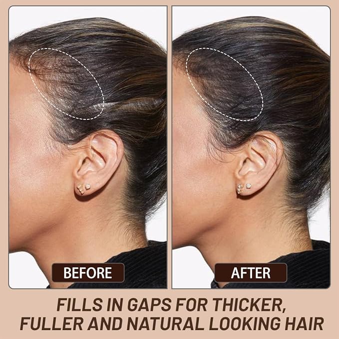 VOLLUCK Root Touch up Powder, Instant Hairline Powder for Thinning Areas and Gray Hair Coverage, Natural and Non-greasy Root Cover up for Women and Men (Light Brown, 0.35 Ounce)