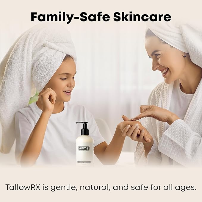 TALLOWRX Tallow Body Lotion – 100% Grass-Fed Beef Tallow for Skin, Face & Body – Pure & Organic Moisturizer with Jojoba Oil, Vitamin E (8 Fl Oz, Lemongrass)