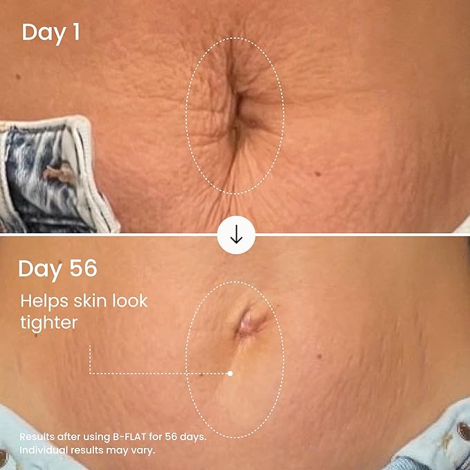 MAËLYS B-FLAT Belly Firming Cream for Women - Skin Tightening & Moisturizing Treatment with Shea Butter & Bentonite Clay - Smooths Look of Stretch Marks - Postpartum Body Care (2 Pack)