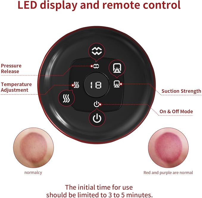 5-in-1 Smart Dynamic Cupping Therapy Massager Set, 12 Levels Heat & Suction Cupping Kit for Massage Therapy, Electric Cupping Device with Red Light Therapy for Back Pain, Knots, Muscle Soreness (Red)