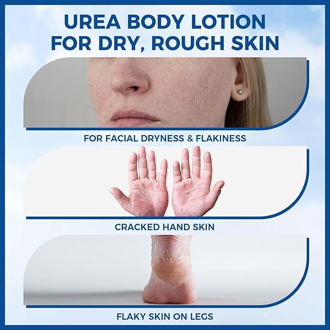 OUKEYA Urea Cream for Dry Chapped Skin with 10% Urea Deep Moisturizer Body Lotion, Softens & Soothes Hands Elbows Feet Hydrates Locks in Moisture, Fast Absorbing & Non-Greasy, 11.28 oz Large Capacity