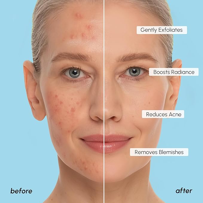 MAREE Glycolic Acid Pads – 200 Toner Pads for Face Cleansing – Facial Exfoliating Pad with Tea Tree Oil, Salicylic Acid & Vitamins E, B3, B5 – Acne Clearing Face Pad, Skin Pore Resurfacing & Radiance