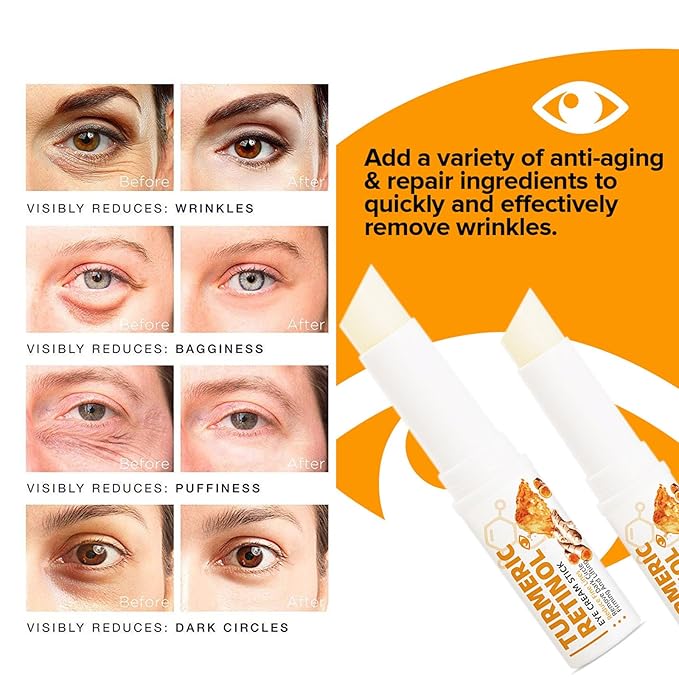 2 PCS Turmeric Retinol Eye Stick,Eye Balm Stick Hydrating for Dark Circle,Wrinkles,Visible Results in 3-4 Weeks,Anti Aging Under Eye For Puffiness and Bags Reduces Fine Lines