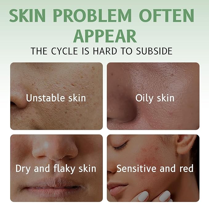 Lucksun Centella Asiatica Cream for Sensitive Skin, 85% Natural Moisturizer, Intensive Hydration & Repair, 50g