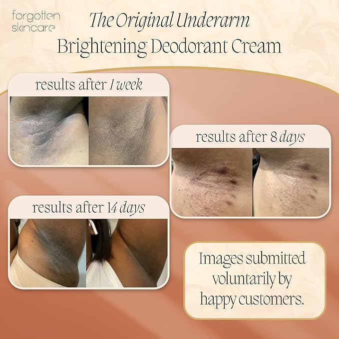 Forgotten Skincare The Original Underarm Brightening Deodorant Cream For Dark Underarms Treatment, Body Odor Eliminator For Women & Men, Ingrown Hair Treatment, Vitamin C & Salicylic Acid
