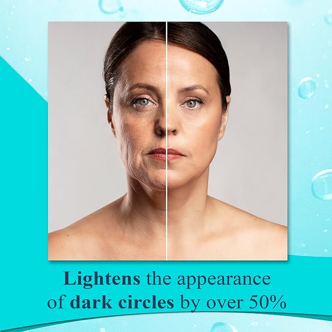 Elite Serum Rx - Eye Serum for Dark Circles and Puffiness with Multi Peptide | Anti Aging Under Eye Serum for Wrinkles, Bags, Fine Lines & Crow's Feet | Eye Treatment for Men Women