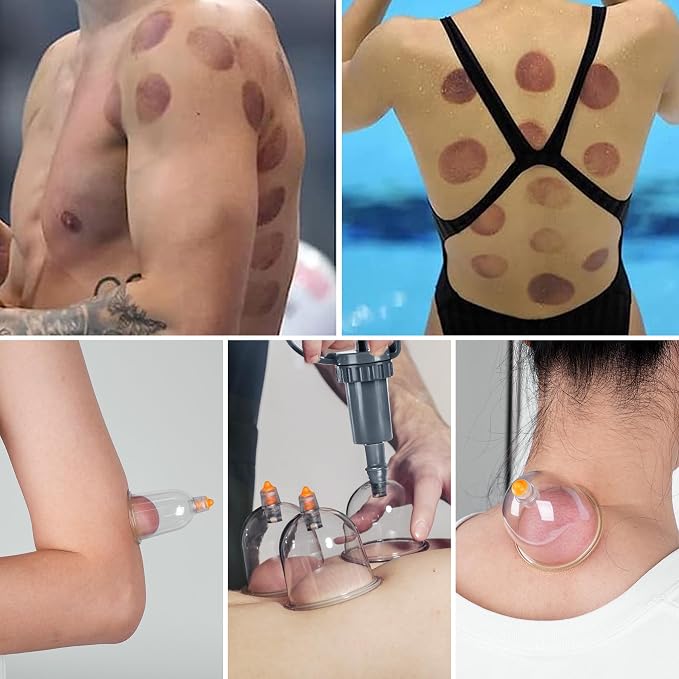 Cupping Therapy Set, 18 Pcs Cupping Set, Professional Cupping Kit for Massage Therapy, Portable Upgrade Cupping with Case, Pump Suction Cups for Cellulite Muscle Pain Relief Physical Therapy.