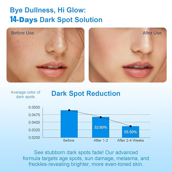 Dark Spot Remover for Face, Dark Spot Corrector, Dark Spot Serum for Sun Spots, Age Spots, Brown Spots,Acne Scars,Melasma Brown Spot -Advanced Formula with Niacinamide Vitamin C 1 Fl Oz (Pack of 1)