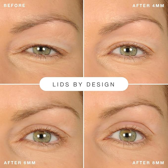 Contours Rx Lids by Design - Non-Surgical & Transparent Eyelid Lift Strips - for a More Youthful-Looking Appearance, Lid Lifting Treatment, Eyelid Tape for Hooded Eyes (4mm)160ct