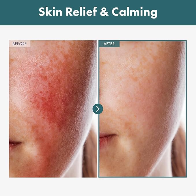 TOSOWOONG Adenosine Cica Cream, 520,000ppm Centella Asiatica, Redness Reducing for Oily and Dry Skin Moisturizer, Barrier Cream with Niacinamide and Panthenol, Korean Skincare, 100ml, 3.38 fl. oz.