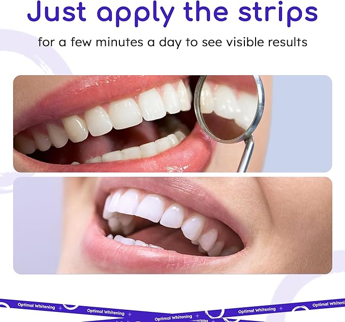 Teeth Whitening Strips for Sensitive Teeth | 14-Day Full Treatment Whitening Kit | Fast-Acting Whitening | Removes Tough Stains | Easy to Use, Comfortable Fit | Self Care & Personal Care Products
