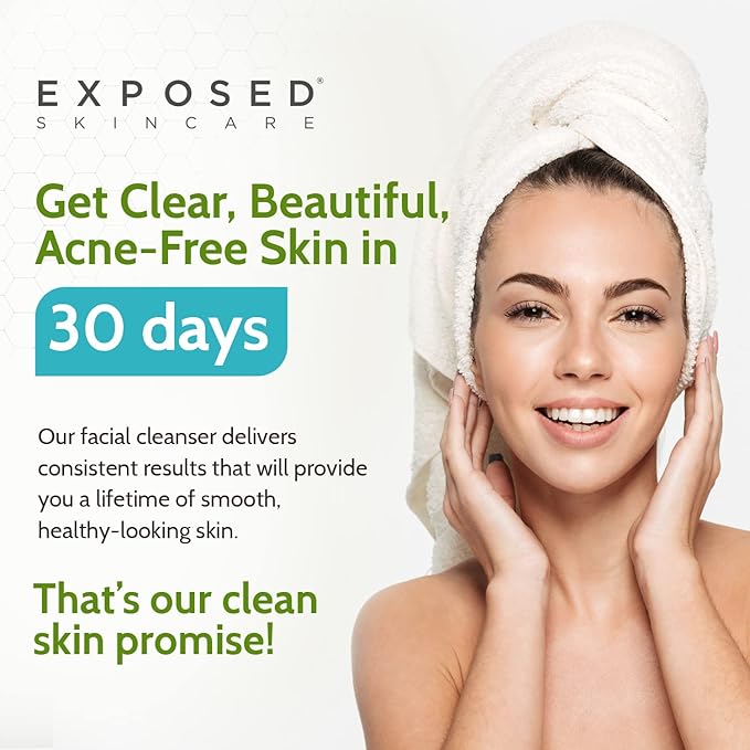 Exposed Skin Care, Acne Facial Cleanser with 0.5% Salicylic Acid for Sensitive and Acne-Prone Skin – Gentle Daily Face Wash for Breakout, Blackhead and Excess Oil – Natural, Non-toxic and Cruelty Free