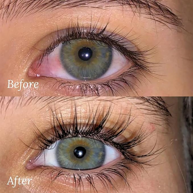 Lash Therapy Australia Eyelash Growth Serum (Available in 5ml & 3ml) – Enhance, Boost & Grow Lashes | Longer, Thicker, Fuller & Naturally Curled Lashes (5ML)