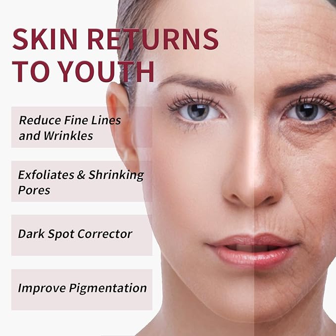 AHA 30% + BHA 2% Peeling Solution Exfoliating Chemical Skin Peel for Face at Home Facial Mask Red Peeling BHA Liquid Exfoliant Acid Peels Salicylic Acid Exfoliators Acid Peel for Face 1Floz