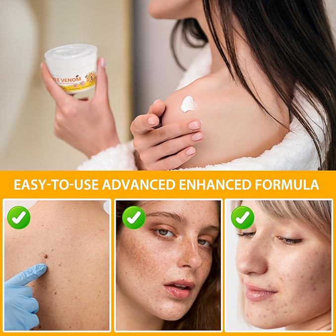 Bee Venom Cream for Face & Body – Hydrating Moisturizing Cream for Dry Skin, Soothing Lotion 3.52 oz