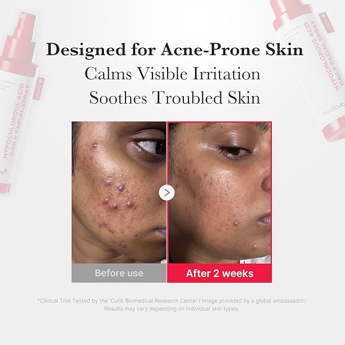 medicube After Sun Care Trio Set: Zero Pore Capsule Cleansing Foam, Collagen Glow Sunscreen, Hypochlorous Acid Power Soothing Spray | Deep Cleanse, Shield & Soothe | Face wash, Sunscreen, Facial Spray