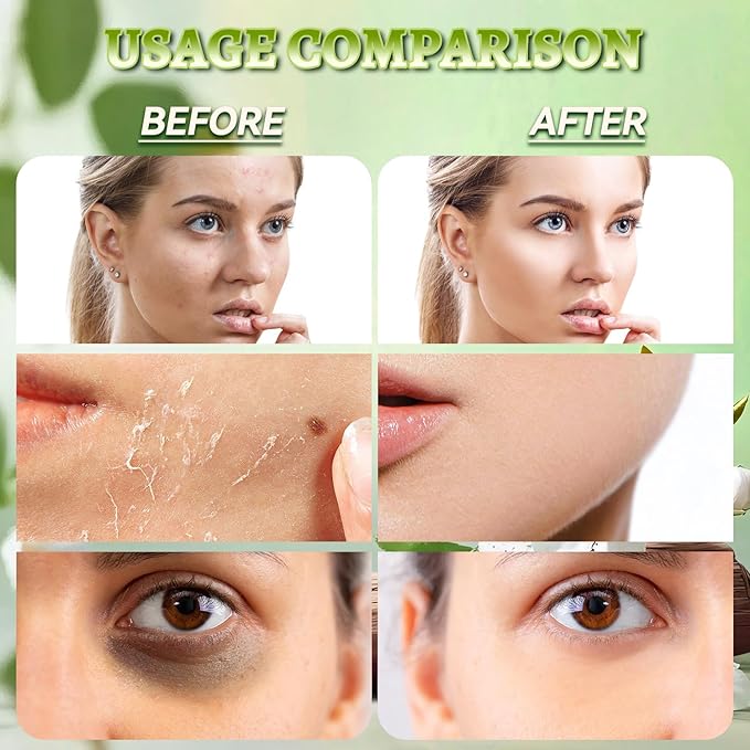 Bee Venom Skin Treatment Cream, Long-Lasting Hydrating & Natural Restoration Balm For All Skin Types, Scientifically-Validated Bee Venom Comprehensive Cream, 2.12 OZ