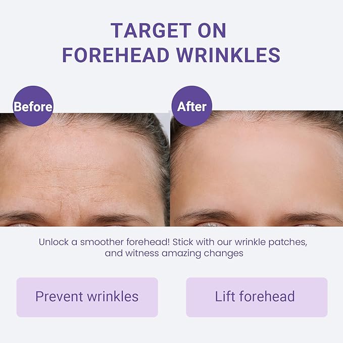 Forehead Wrinkle Patches, Sufchin 20 Pcs Face Lift Tape for Wrinkles Overnight Sweatproof & Hypoallergenic, Anti Wrinkle and Beauty Faical Skincare, Visible Lift & Deep Crease Care for Sensitive Skin