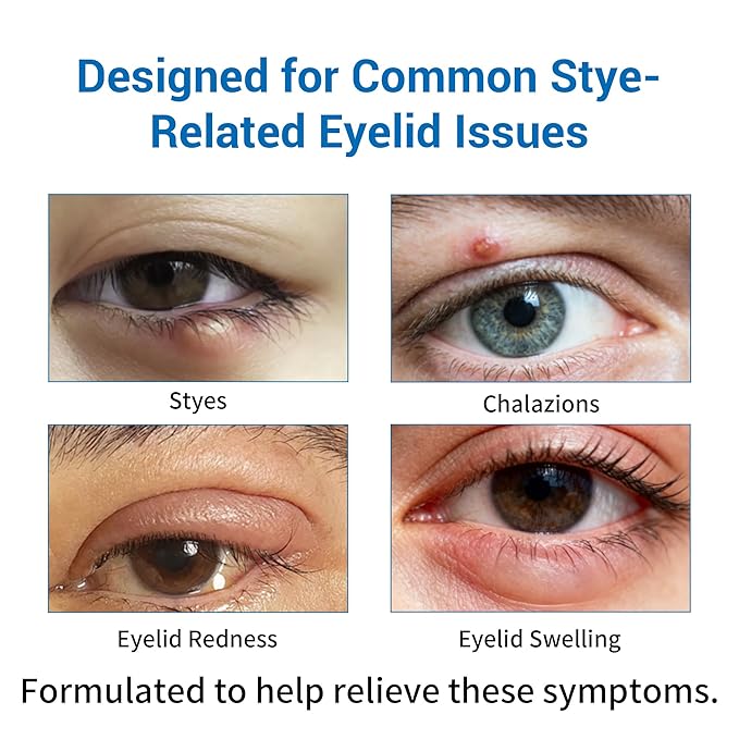 Stye Eye Treatment Kit, Stye Relief Rollerball Serum and Eye Patches for Styes, Chalazions and Blepharitis Treatment for Eyelids, Stye Eye Compress, Clear Eyes Redness Relief, Sleep Eye Mask