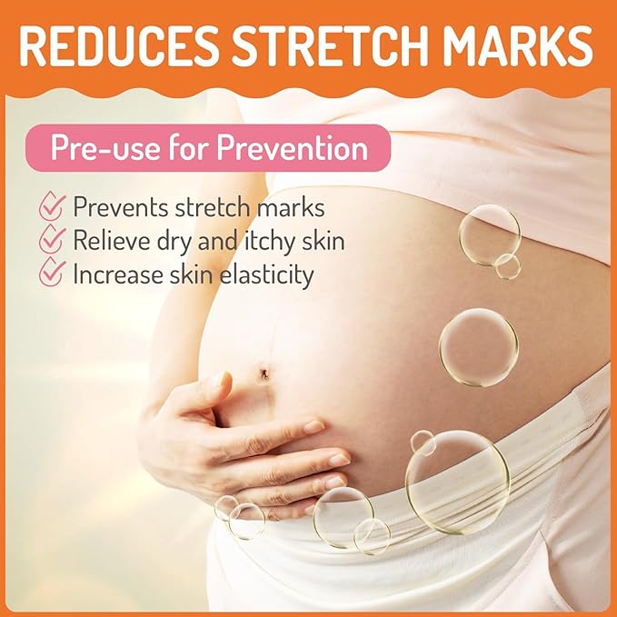 Stretch Mark Belly Butter-Packed with Vitamin E, Coconut Oil, and Sunflower Seed Oil to Protect, Soothe, and Rejuvenate Skin - Safe for Pregnancy and Nursing-Repair Stretch Marks and Scars.7.055oz