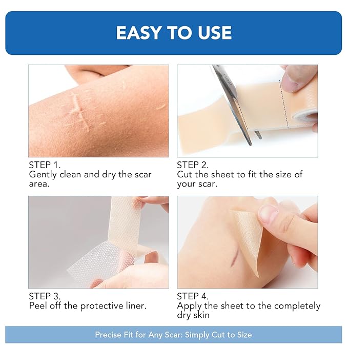 Silicone Scar Sheets, Silicone Scar Tape(1.6"x 60" Roll-1.5M) - Reusable, Soft & Medical Grade Adhesive Tape for Old & New Scars, C-Section, Surgery, Keloid & Acne Scars