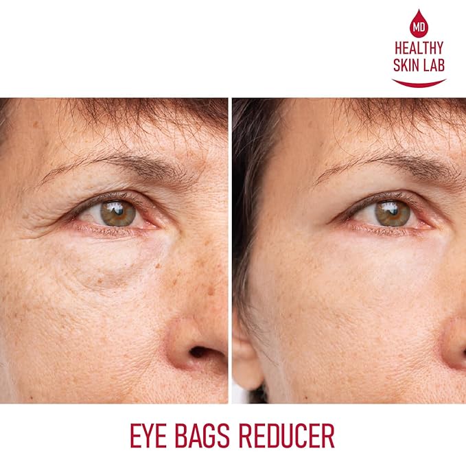 Healthy Skin Lab Reusable Under Eye Patches, Reduce Dark Circles, Puffy Eyes, Undereye Bags & Wrinkles - Medical-Grade Silicon Patches Reusable For Up To 3 Weeks