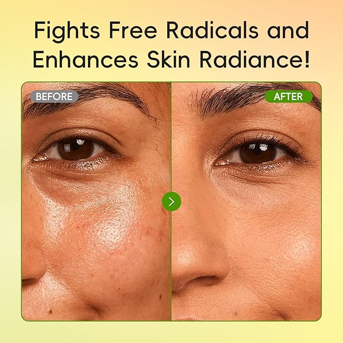 Skin Care Set for Oily/Combination Ance Skin, Natural Fruit Skincare Kit with Salicylic Acid, Vit-C & Peptide, Birthday Gifts for Women | Oil Control | Brightening | Anti-Acne | Gift Sets