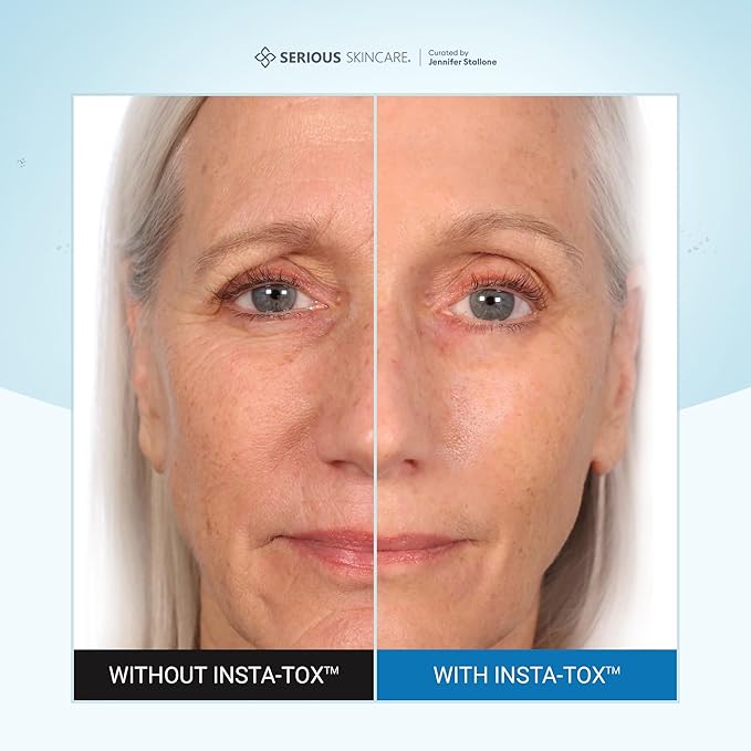 Serious Skincare INSTA-TOX Instant Wrinkle Filler for Face Serum, to Smooth + Blur Fine Lines, Deep Wrinkles, Lip Lines, Crow’s Feet & Pores, Temporary Face Tightener, .75 oz (Pack of 2)