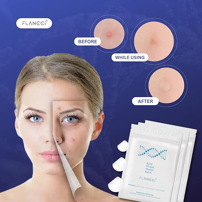 Pimple Patch Acne Patches Facial Skin Care Products, Blackhead Remover Skincare, Pimple Patch for Face and Hydrocolloid Acne Treatment Patch Salicylic Acid, Acne Spot Treatment (72 Count (Pack of 3))