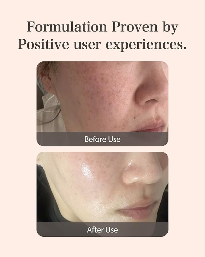 MASTINA Mastic Ampoule Serum (2-Pack, 0.5fl oz Each), Korean Face Serum with 63% Mastic Complex & Niacinamide for Firming & Hydrating, Great Value Pack