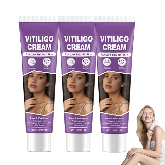 Vitiligo Cream, Vitiligo Treatment Cream， Reduce White Spots，Easy to Use