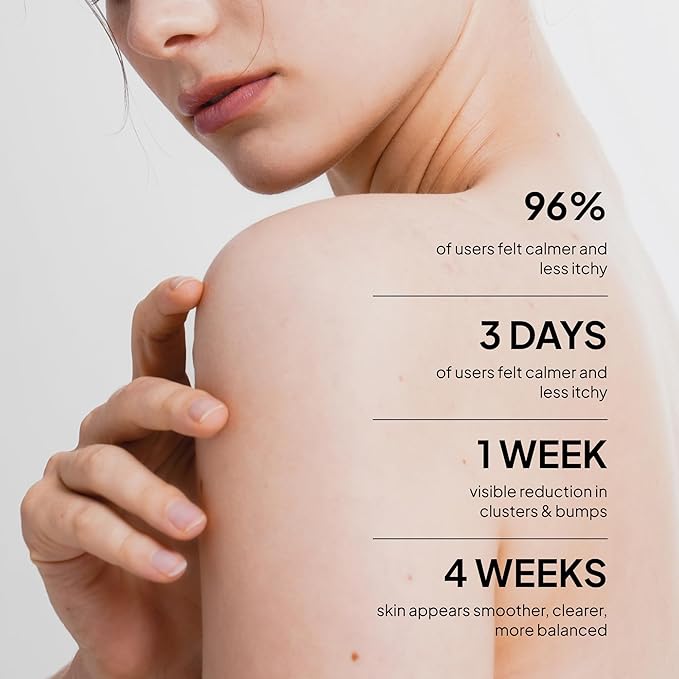 BellamiLuxx Fungal Acne Treatment Lotion: Effective Face & Body Pimple Cream for Bumps, Clusters, Itch & Redness – Fungal Prone Skin Acne Treatment Moisturizer for Teens & Adults with Natural Actives