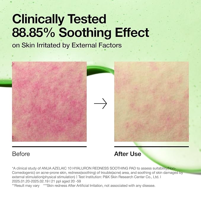 Anua Azelaic Acid Redness Soothing Prep & Boost Duo, Soothing & Calming Synergy, Spot care with Mini Sheet mask for Day & Night Routine, Korean skincare set