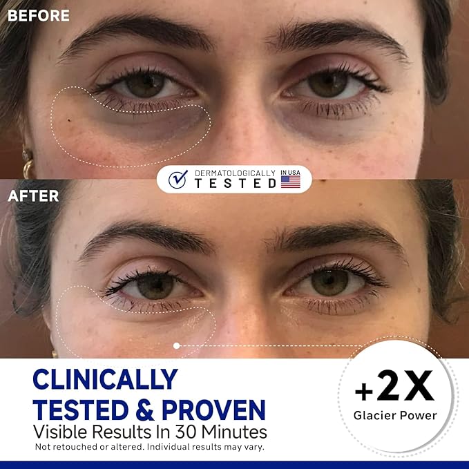 Peptide Cooling Under Eye Patches, Soothing Eye Patches Instant Reduces Dark Circles and Puffiness, Calming Under Eye Mask with Glacial Water for Bags Treatment, 60 Pairs