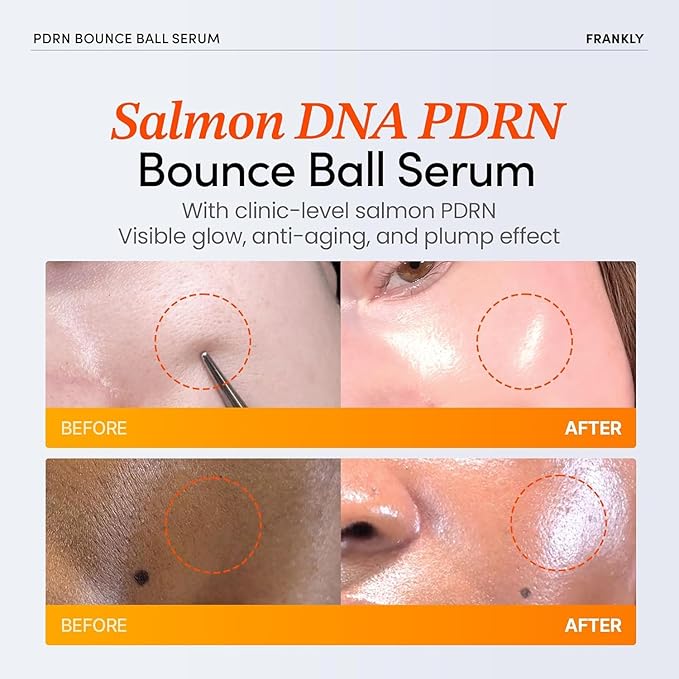 FRANKLY Salmon PDRN Bounce Ball Serum – 99% Pure PDRN Salmon DNA for Post Microneedling Recovery, Redness & Damaged Skin Repair | Glass Skin Korean Skincare | Lightweight, Non Sticky | 1.01 fl oz
